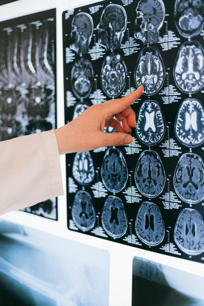 A doctor pointing at a brain on a grid of brain scans